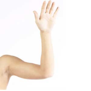 Arm
