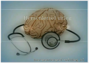 Agnosie en Prosopagnosie