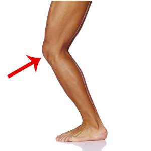 Knie